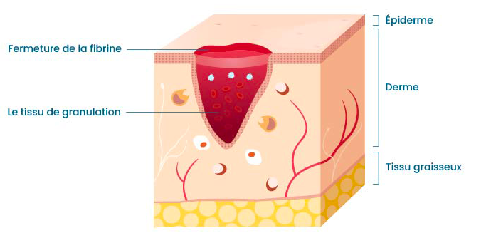 illustration de la cicatrisation