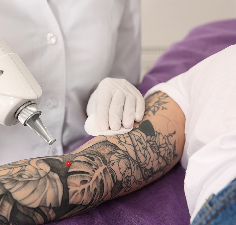 Cicatrisation tatouage